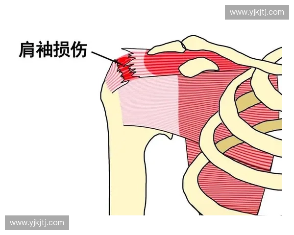 运动损伤预防与康复策略及功能恢复综合指南